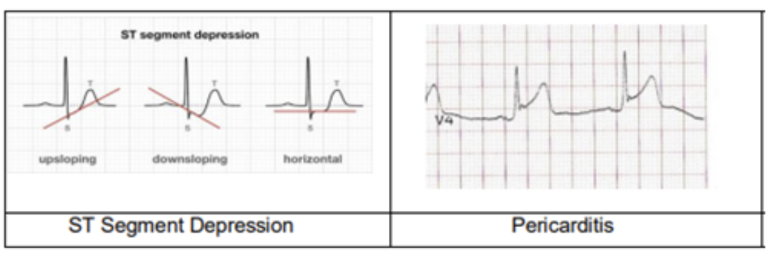 Pathological variants